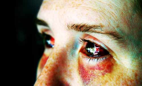 red eyed lady image